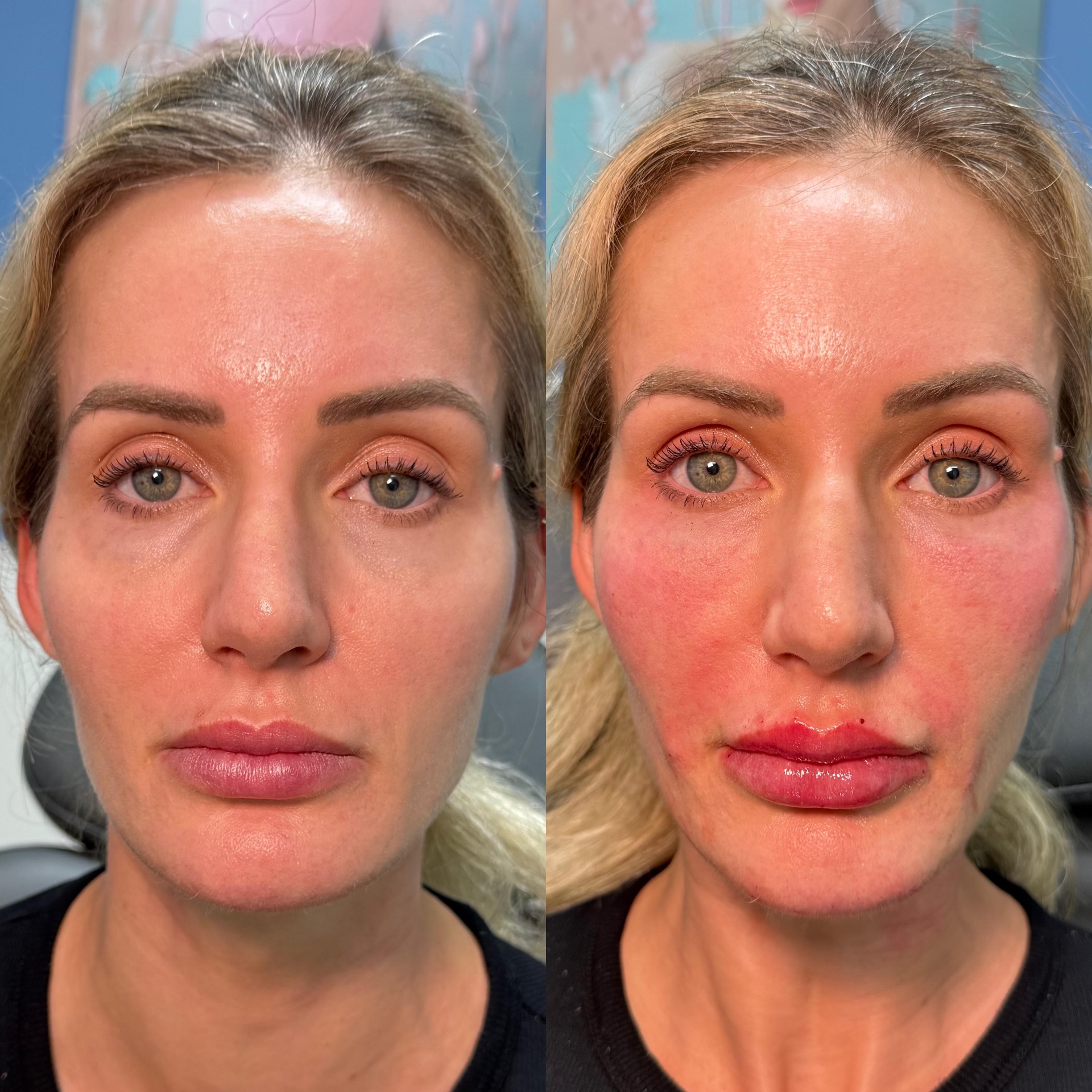 Cutting-Edge Treatments Offered at Eternia Medspa